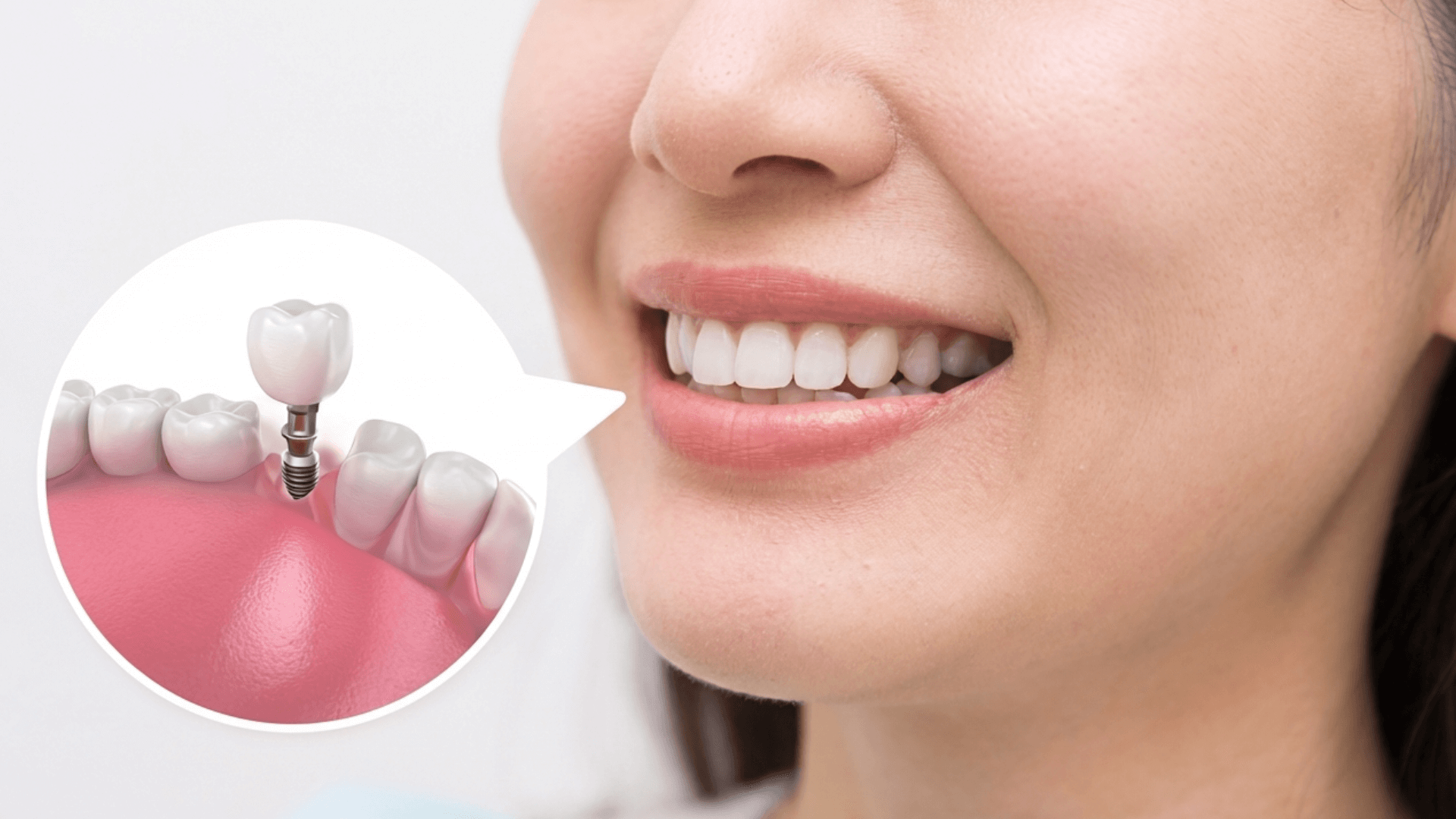 待機期間のイメージ