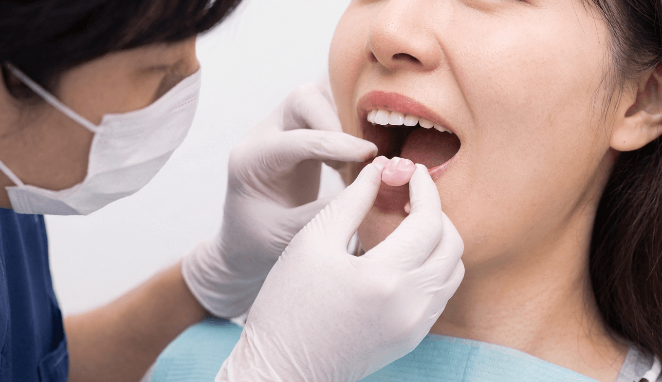 人工歯装着の様子