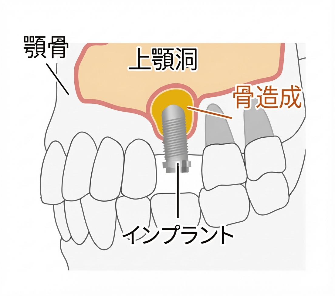 手術に伴うリスクの図解