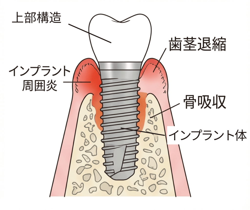 長期的なリスクの図解